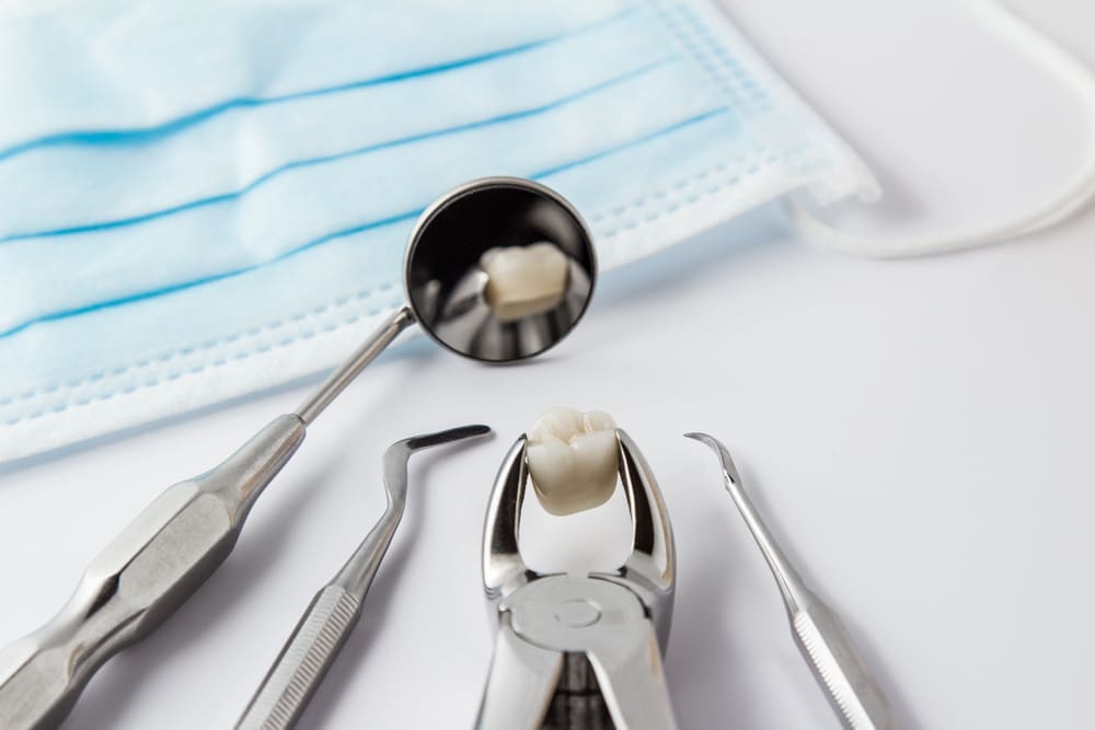 Emergency Tooth Extraction What to Expect